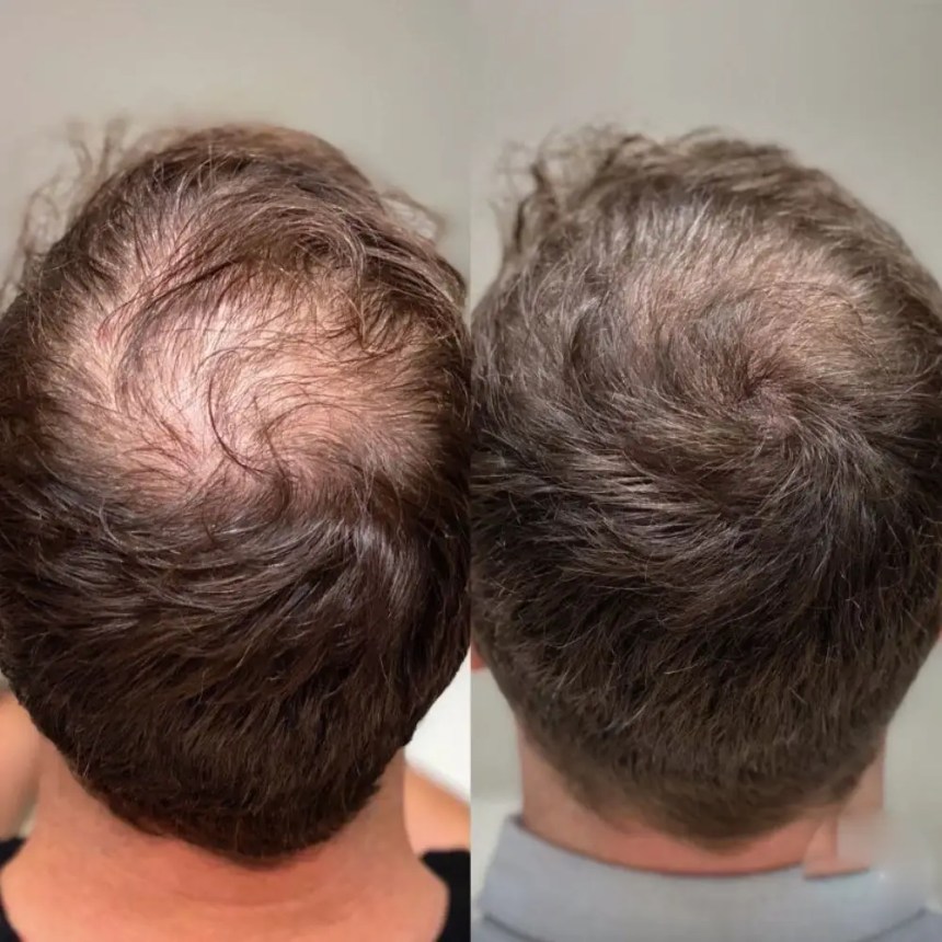 Magic Spells: Hair Growth&nbsp;Rituals